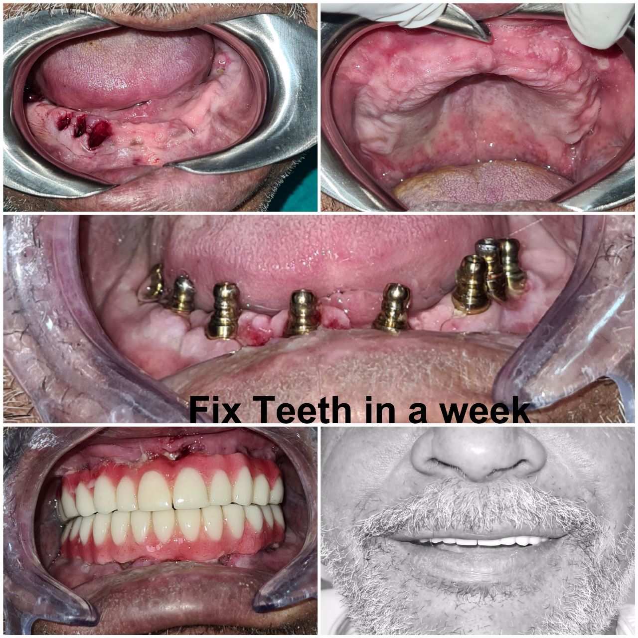 Best Dentist in Chandigarh