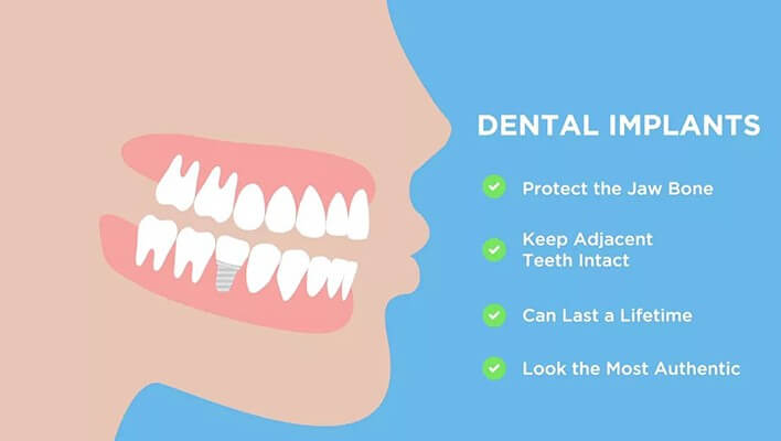 Best Dentist in Chandigarh