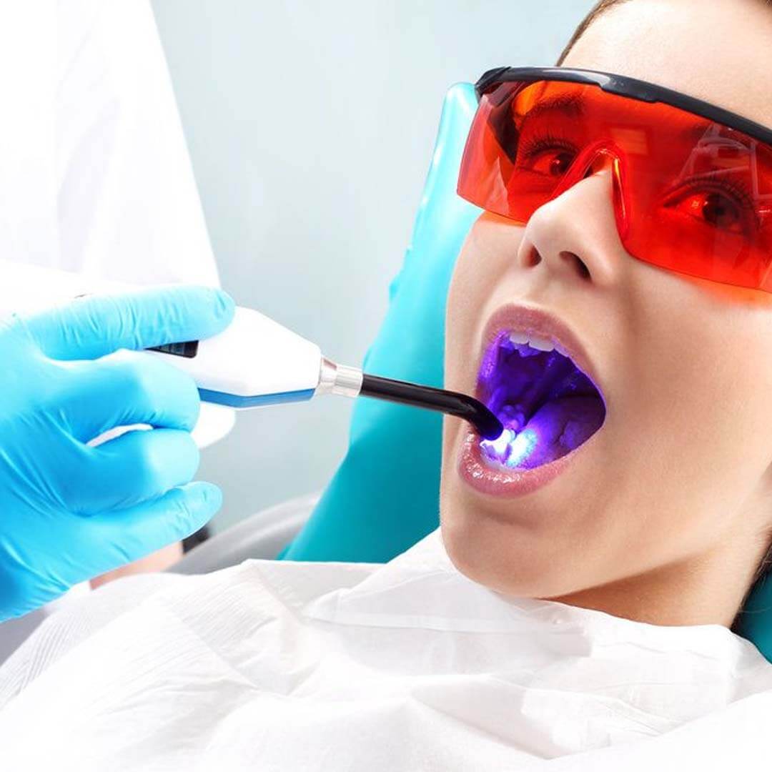 Dental Laser Treatments in Haryana