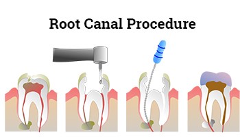 RCT in Ambala